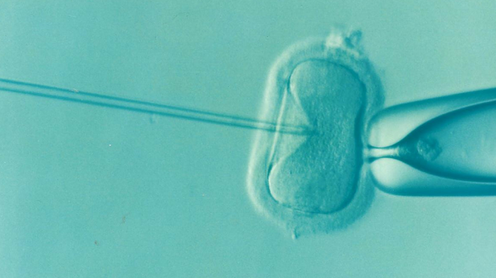 Micrograph of IVF process