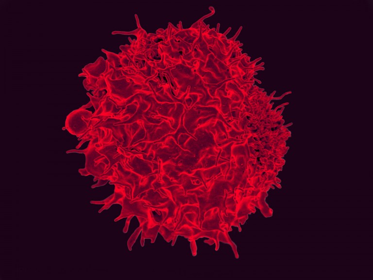 A Human T Cell
