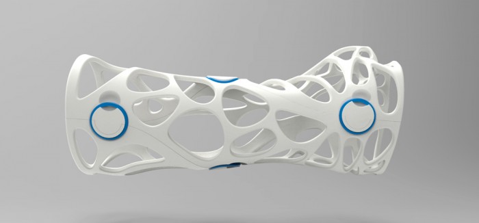 This 3D printed cast could be the future of healing broken bones