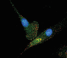 Endometriosis macrophages (multi-function immunity cells)