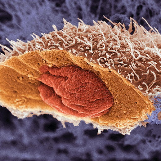 single cell of squamous cell