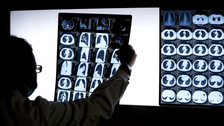 An image of a doctor looking at medical scans.