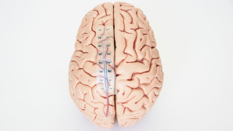 brain implants