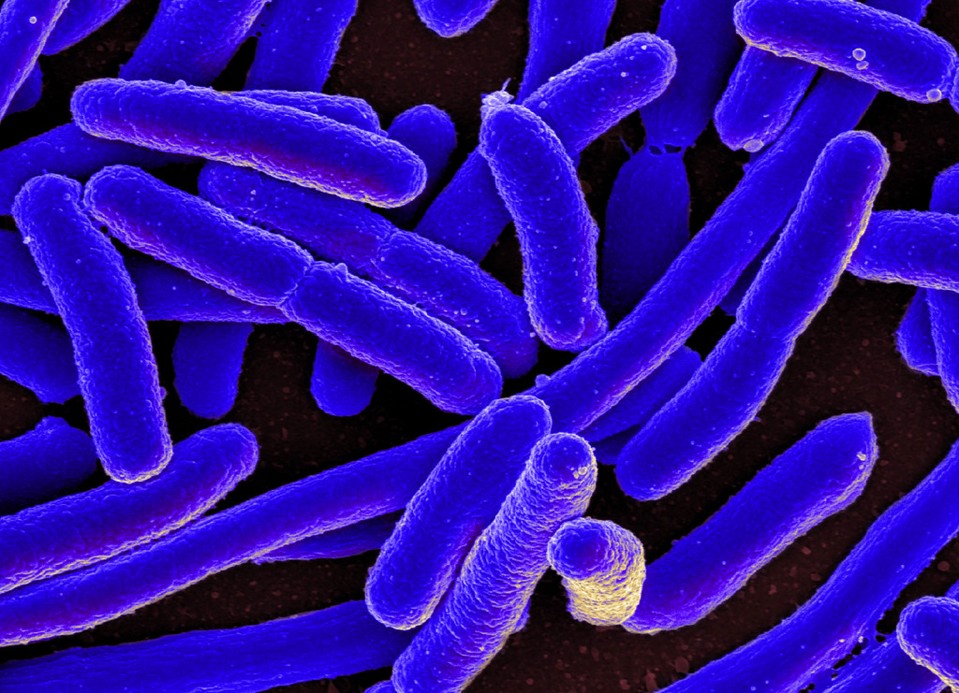 Micrograph of E. coli