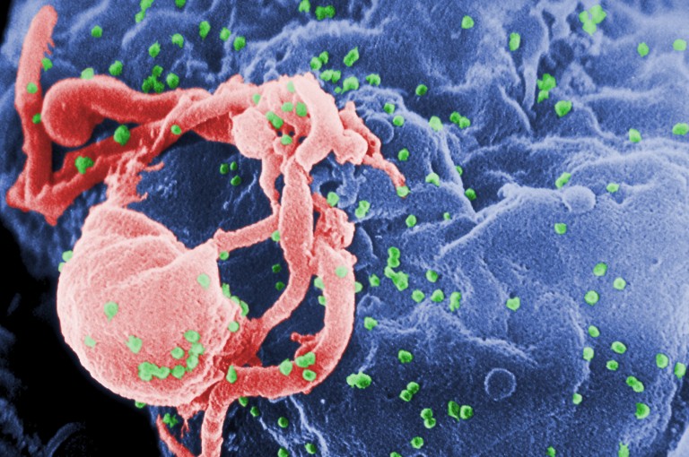 An image of HIV-1 budding (in green) from a cultured lymphocyte