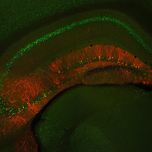 a mouse hippocampus (where memories are stored in mammals)