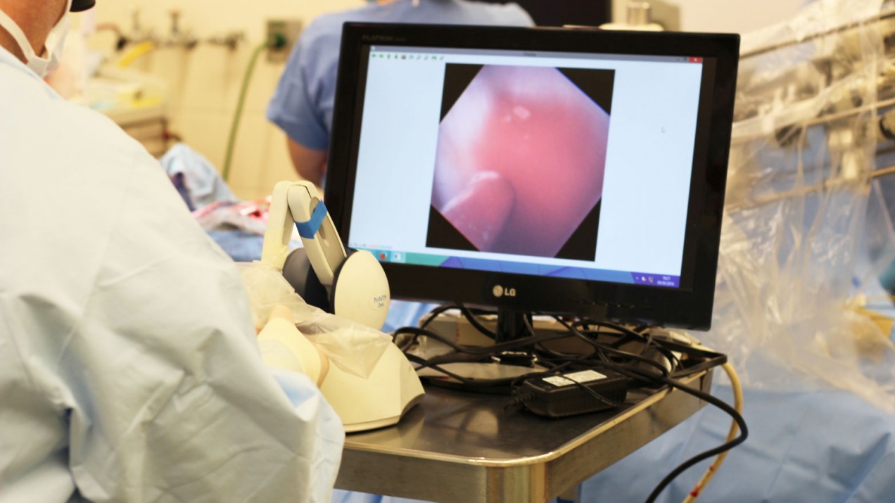 Image of medical professional looking at laparoscopy viewing screen