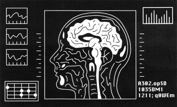 Illustration of brain scan