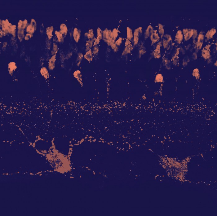 Micrograph of mouse retinal cells