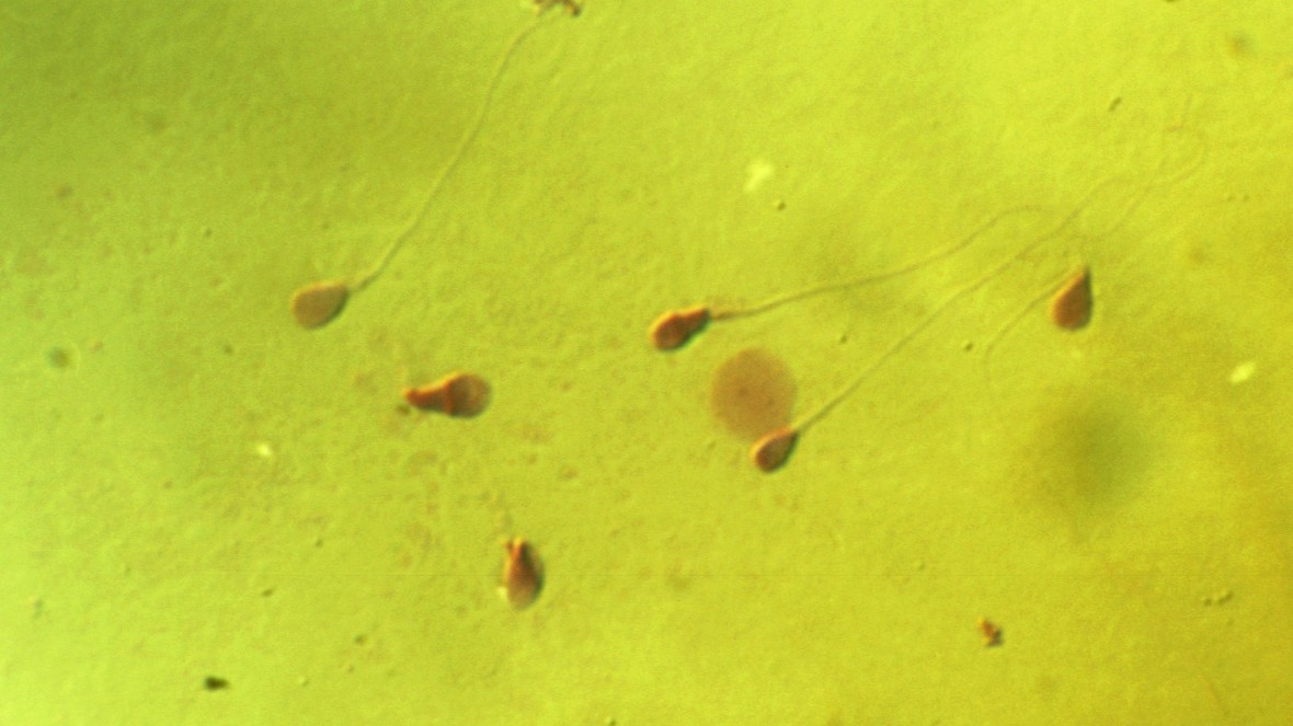 Microscopic photograph of human sperm